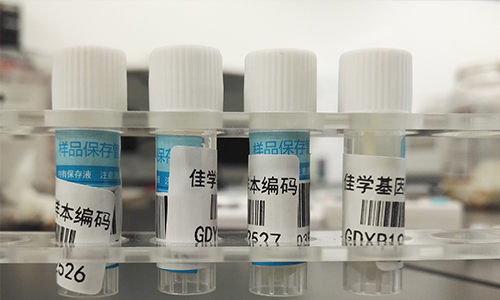 【佳學(xué)基因檢測】如何做非梗阻性無精子癥基因解碼、<a href=http://www.hyjhsj.com/tk/jiema/cexujishu/2021/31933.html>基因檢測</a>？