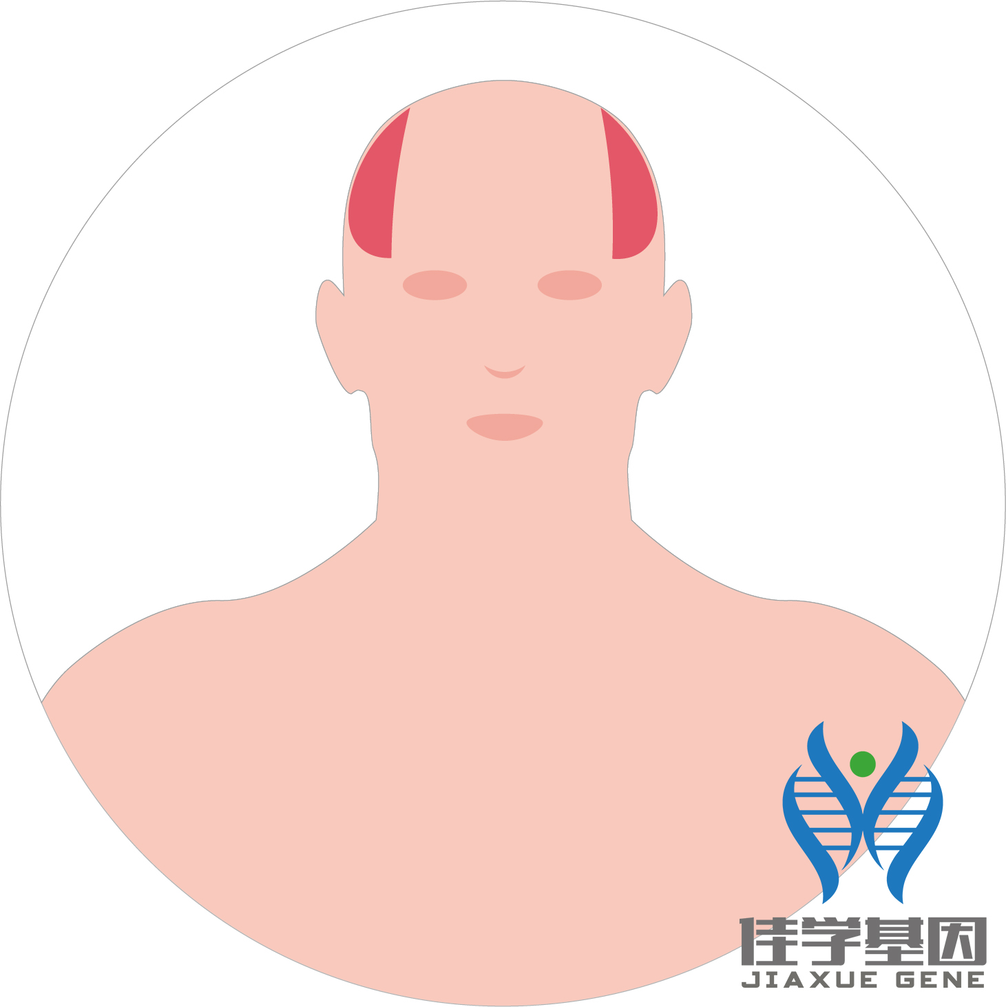 【佳學(xué)基因檢測(cè)】男性<font color='red'>脫發(fā)</font>（Androgenetic alopecia）基因解碼、<a href=http://www.hyjhsj.com/tk/jiema/cexujishu/2021/31933.html>基因檢測(cè)</a>