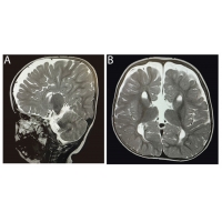 <b>【佳學(xué)基因檢測</b>