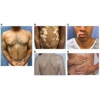 【佳學(xué)基因檢測