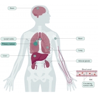 【佳學(xué)基因檢測(cè)】小細(xì)胞<font color='red'>肺癌</font>基因檢測(cè)：知識(shí)、背景與依據(jù)