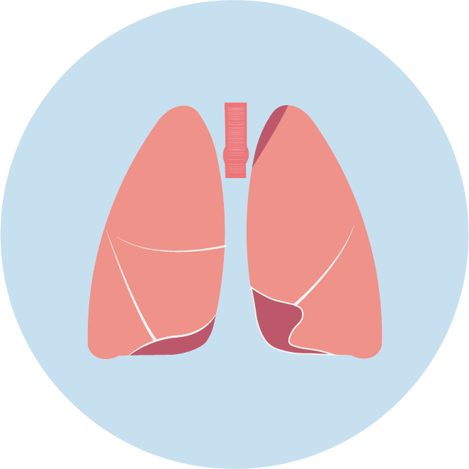 <b>【佳學(xué)基因檢測】非小細胞肺癌靶向治療藥物泰圣奇基因檢測</b>